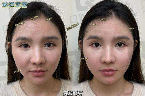 1、郑州美时美刻殷金金医生怎么样?