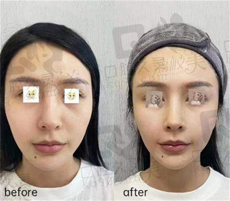 6、郑州美时美刻殷金金医生预约挂号指南