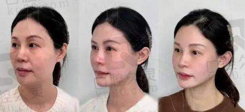 成都米兰柏羽刘小娇塑妍萃优势分析