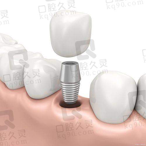 上海鼎植医生马列项目价格表参考