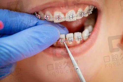 治疗后需要注意什么?