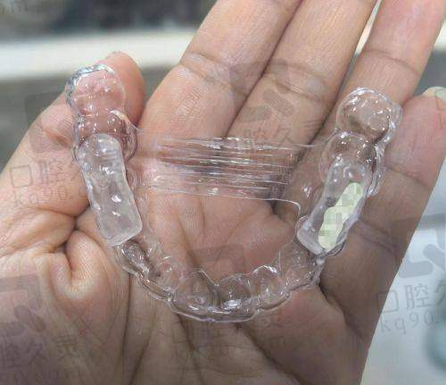 隐形矫正技术有什么特色?