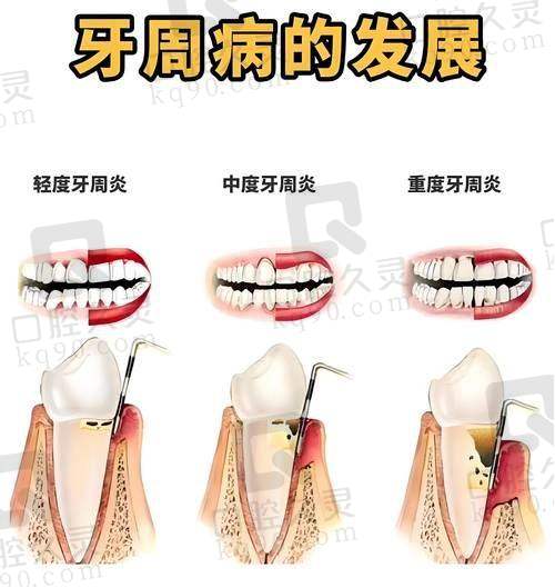 矫正成效怎么样?