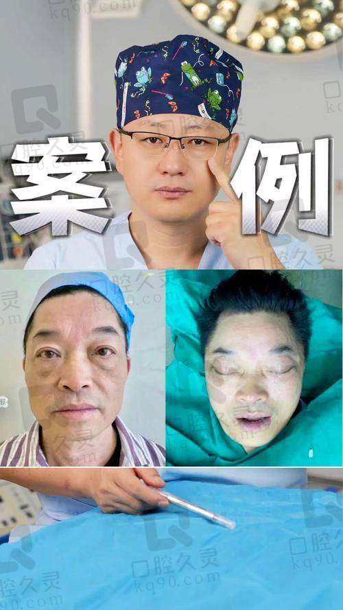 面部拉皮有风险吗?倪锋医生强调术前沟通+术后管理