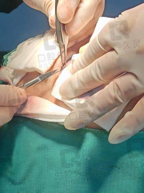 上海倪锋医生是九院出来的吗?走进上海伯思立,探寻面部年轻化专家的履历之谜