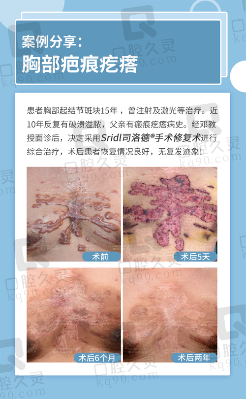 西宁韩美整形医院疤痕修复体验：淡化疤痕痕迹，重拾肌肤自信，效果令人惊喜 