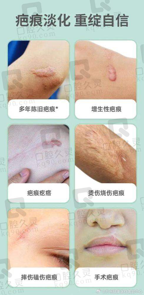 西宁韩美整形医院疤痕修复有哪些技术?