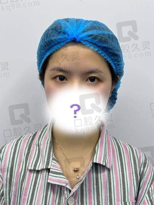 八大处王太玲双眼皮修复水平怎么样可靠吗?