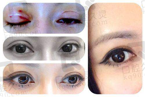 八大处王太玲在哪家医院