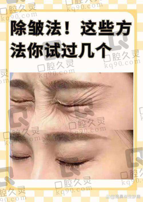 深圳瑞芙臣医疗美容射频提升成效如何?