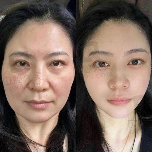 四、价格优势:性价比高