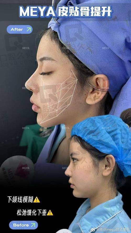 三、骨干医生操刀:技术好经验多