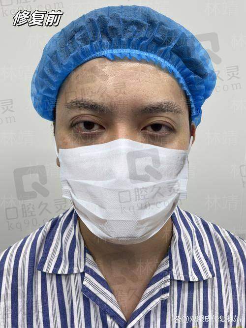 避雷5:多数人忽视审美,这是决定自然不自然的关键