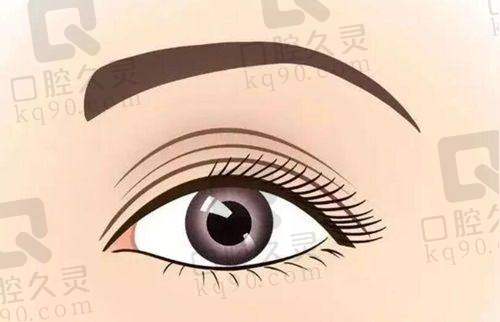 管果医生双眼皮做得好吗?沪上实力派医师,精细技术与大量成功案例曝光