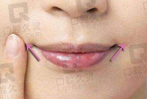 无锡施尔美整形医院靠谱吗？专业医师、先进技术、优质服务打造放心医美体验