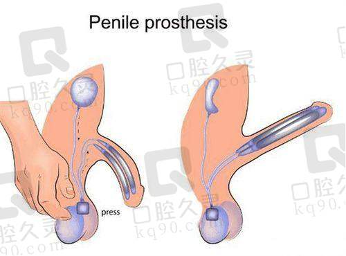 与其他美容医院相比,无锡施尔美医疗美容医院有什么优势?
