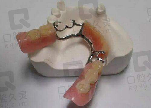 固原舒康口腔医院靠谱吗?正规二级专科,种植牙3500元起,附价格表及地址