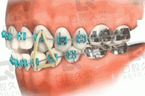 汪园项目价格表参考