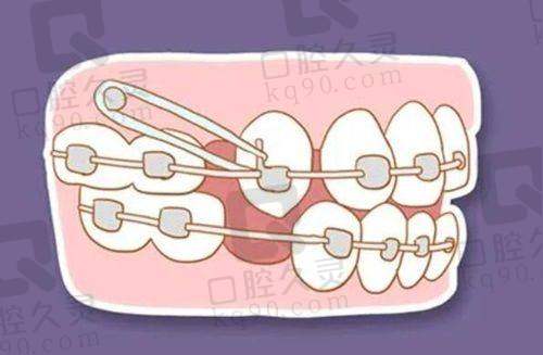 吉安仁心口腔医院怎么样?专业服务、先进技术,铸就口腔健康新体验!