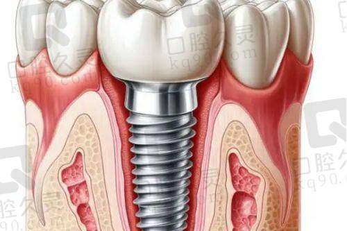 上海鼎植医生周建亭口碑和评价