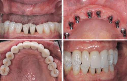 上海鼎植医生周建亭怎么预约?