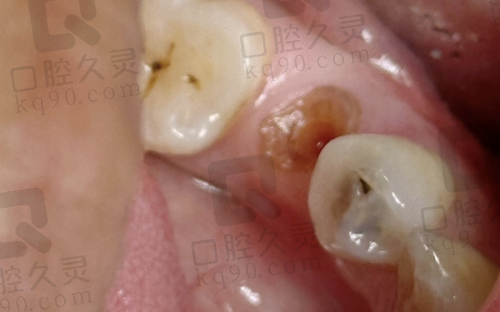 上海鼎植医生周建亭种植牙水平怎么样 ?