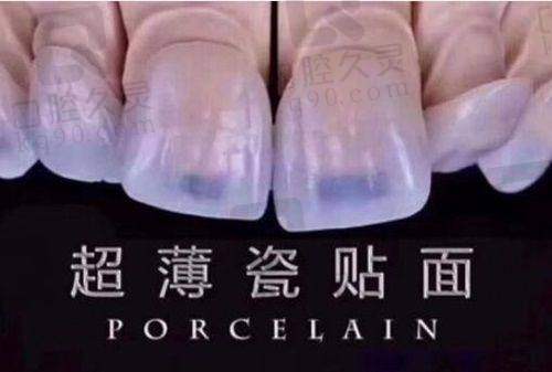 吉安仁心口腔医院的口碑如何?