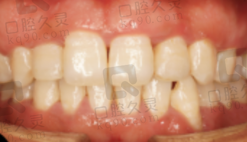 银川诺贝尔牙科价目表