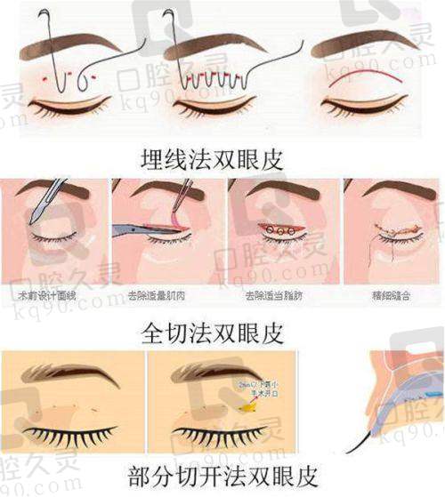 为什么要通过预约电话联系无锡施尔美医疗美容医院?