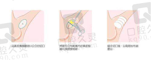 无锡施尔美医疗美容医院预约电话,专业医美服务、多样项目及优质医师等你来询