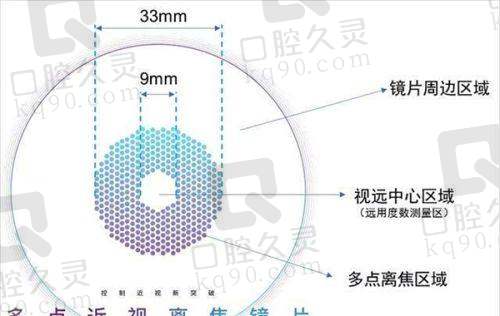 2025济南明水眼科收费价格表:涵盖近视矫正、白内障治疗等项目费用