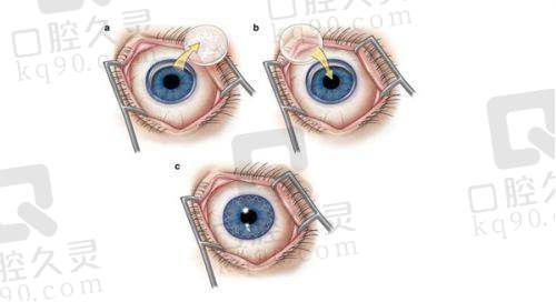 哈尔滨爱尔眼科医院地址在哪？地处道里哈药路，交通便利且医疗服务优质 
