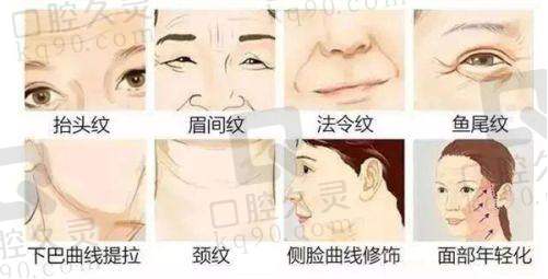 无锡施尔美整形医院除皱针体验分享，轻松淡化皱纹，重焕肌肤年轻光彩超惊喜 