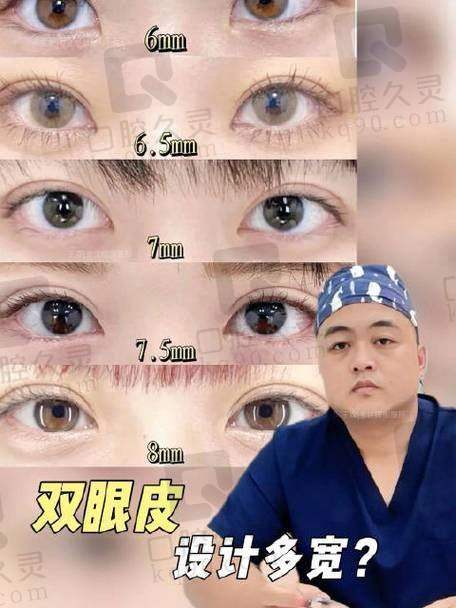 为什么那么多人选择管果医生做双眼皮手术?用户反馈特别直接