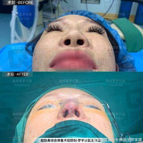 无锡施尔美整形医院鼻综合整形技术特色