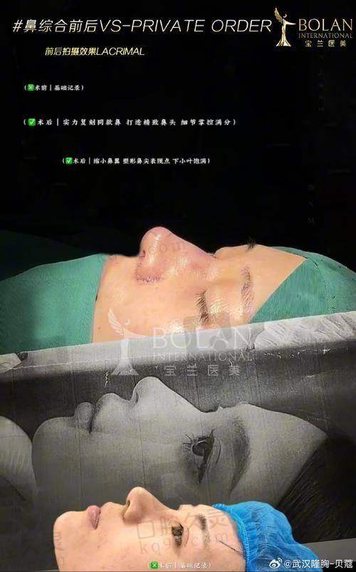 手术过程:紧张与期待并存