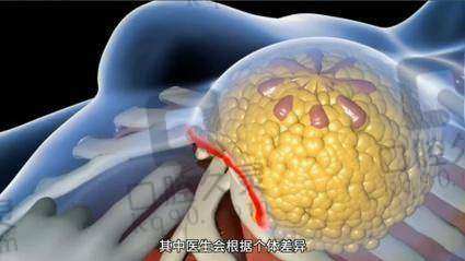 包涛医生之前在哪上班?武汉仁爱时光院长隆胸、丰臀绝技背后的职业履历