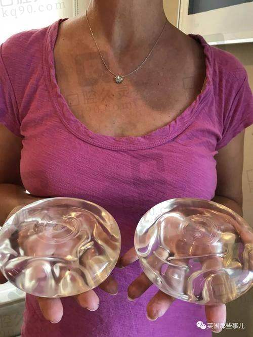 梁耀婵的自体脂肪隆胸技术:兼顾自然手感与成活率