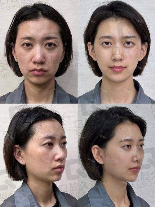 四、闫伦医生口碑怎么样?