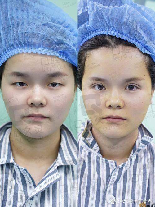 三、闫伦医生技术怎么样?