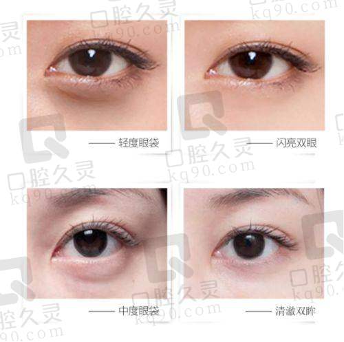 清潭First整形:眼部修复专家,高满意度成就口碑之选