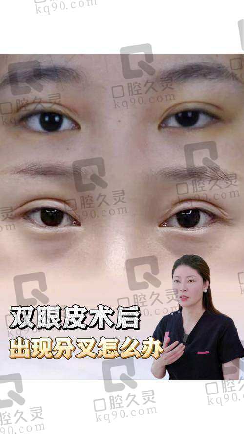 上海马娟医生在哪家医院?在新华、冰妍等多院坐诊进行双眼皮修复手术